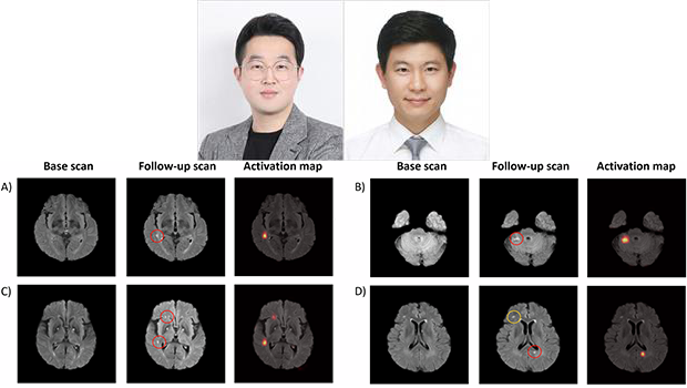 인천대 조환호 교수 연구팀, 한양대 구리병원 박성호 교수팀과 협력…‘무증상 뇌경색’ 자동 탐지 AI 모델 개발 대표이미지